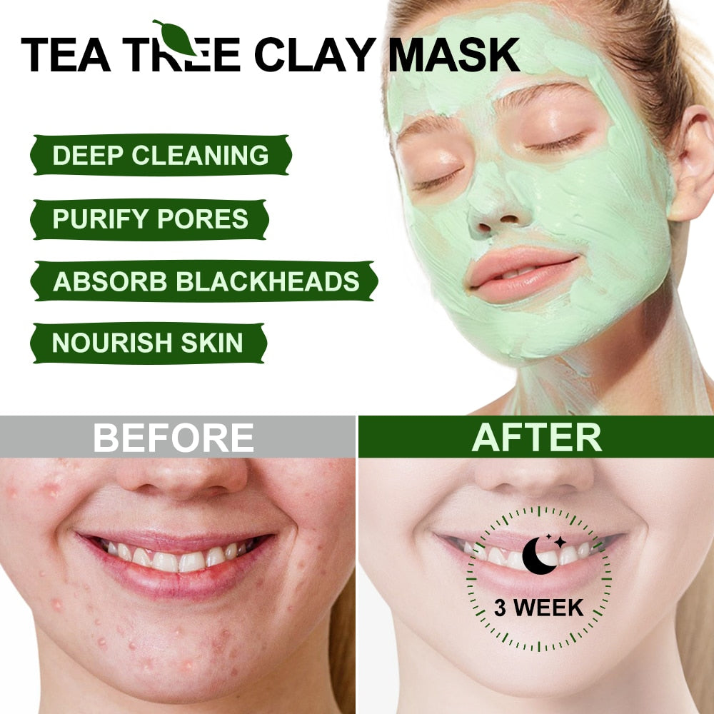 Tea Tree Acne Facial Mask: Pore Cleaning